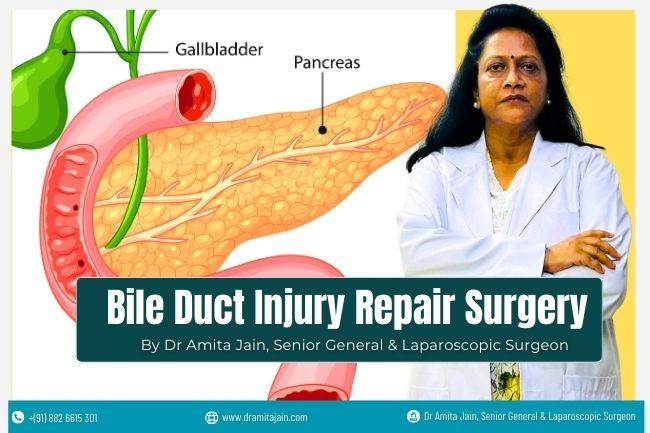 Bile Duct Injury Repair Surgery in Delhi Dr Amita Jain Best Bile Duct Injury Repair Surgery by Dr Amita Jain